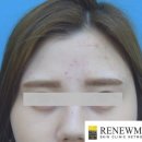 리뉴미 피부과 의원 이미지