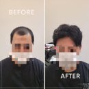 스타일모모 | 일산가발, 고민 끝에 다녀온 스타일모모 맞춤가발 상담 후기!