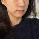 신지정로 | 원주기업도시 피부관리ㅣ바넬ㅣ미백 케어 후기ㅣ나노멜라케어