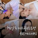 뷰리에 | 계산동 피부관리 뷰리에스테틱 아쿠아필 솔직 후기