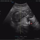 정평봄산부인과의원 네이버블로그