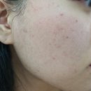 아크네마인드의원 이미지