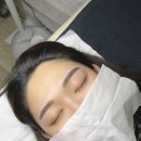 임브로우