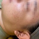 수야에스테틱