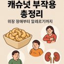 캐슈넛 부작용 총정리 | 위장 장애부터 알레르기까지 이미지