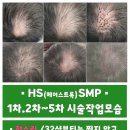 채움에듀 - 노원구 월계로 370 | [공지] 정수리 탈모 고민 해결! 32샵뷰티에듀솔루션 두피채움 SMP 솔직 담백 후기[남동생찐후기]