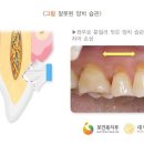 미듬치과 네이버블로그