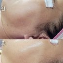 휴테라피 이미지