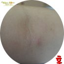 뽕뽕이약국 | [펀펀육아 이시스파마 세칼리아밤 후기] 보습크림추천~*