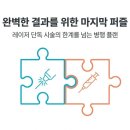 알파레이저