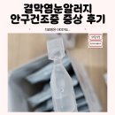 풍림무약(주) | 결막염눈알러지후기, 안구건조증치료후기 점안액주의사항!