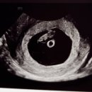 신세계노래팡 | 다낭성 임신일기🍼 7주차~8주차 : 첫 심장소리와 양가 임밍아웃✨(+ 임신초기해야할일 리스트)