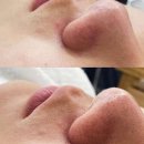 고원장의모공세척테라피구월점