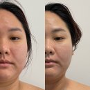 [김해/삼방동] 김해에스테틱 김해윤곽관리 김해신부관리 &#34;디아뷰티&#34; 작은얼굴관리 후기