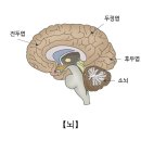 거스트만 증후군 (Gerstmann Syndrome) 이미지