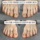 노가니길2(새마을금고 앞) | 페디프로 부천역곡점에서 무좀발톱 스케일링으로 효도한 후기