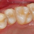 리봄치과의원 이미지