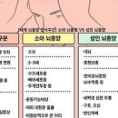 뇌암 악성 뇌종양 의심 원인 이미지