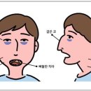 예스안치과의원 네이버블로그