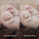 경산 중산동 피부관리 프리미엄 재생관리 프리즘관리 신부관리 에스테틱 추천 물오른피부 경산점 솔직후기