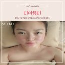 ▶김해 삼방동◀ 삼방동피부관리 디아뷰티 시술후기