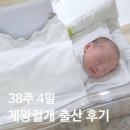 차좀볼줄압니더 | 은평구 아이제일산부인과 제왕절개 출산 후기 1일차