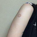 영운분식 | [일상] 백신으로 얻은 황금휴가