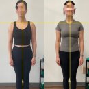 관골 | 잠실새내 필라테스 체형교정 후기 (사진 Before &amp; After)