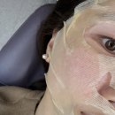 (주)해내 | 압구정피부과 줄기세포 피부주사 찐 내돈내산 후기 여기서 받아야하는 이유