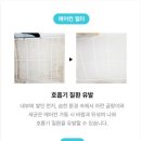 뷰 클리닝 이미지