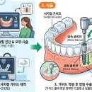 백세치과기공소 네이버블로그