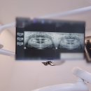 행복을 주는 치과 | 부산치과 스케일링 불소치료 후기