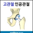 강서구 미라클-메디 특구 병원! 웰튼병원에서 고관절인공관절로 새 인생을!! 이미지