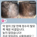 (주)그린헬스케어 | 한방 복합 추출물과 첨단 기술의 만남 광주 AA&amp;T '해파 올인원 샴푸', 1달 사용 후기