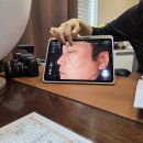 레이저 | 종로피부과 남자 기미 잡티제거 루비레이저 후기