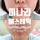 화이트밸리 | 부천 미나리 에스테틱 | 30년 경력 전문가에게 받은 얼굴 비대칭 윤곽관리 솔직리뷰