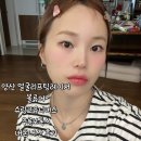 양산 얼굴리프팅 볼류머 + 슈링크유니버스 스킨보톡스 주름보톡스 내돈내산 후기 시술통증