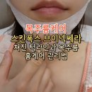 주식회사 늘바른 | 목주름팩 목주름관리법 skinfox 브이넥쎄라 사용후기