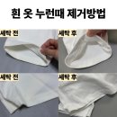 지나세탁소 | 흰옷 누런때 세탁소에서도 못지운 얼룩 제거후기