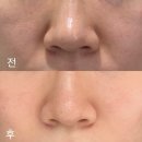 율하리틀병원 | 김해 장유 포텐자 쥬베룩 후기 율하 피부과