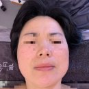 늘,고운피부 이미지