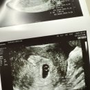 선덕한의원 이미지