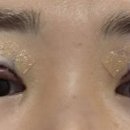 아이컨텍성형외과의원 이미지