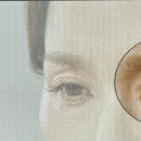 바르다성형외과의원 네이버블로그