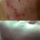 르베르뷰티&아카데미 이미지