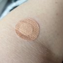 유승진내과의원 | 건강검진, 정신 혼미했던 비수면 내시경 경험기