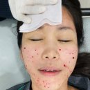 차오름약국 | 쥬베룩 볼륨 유지 기간 및 주기 2회차 블룸 후기 (가격,효과)