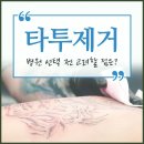차이란 | 컬러 타투제거후기 차이를 체크하여