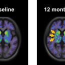 테크메딕스 이미지