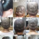 흠평경락관리 | 흠평경락관리,부천흠평경락관리,부천경락관리,소사경락관리,원미경락관리,오정경락관리,소사종합시장...